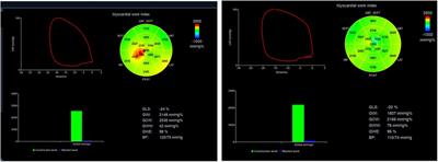 Incremental value of non-invasive myocardial work for the evaluation and prediction of coronary microvascular dysfunction in angina with no obstructive coronary artery disease